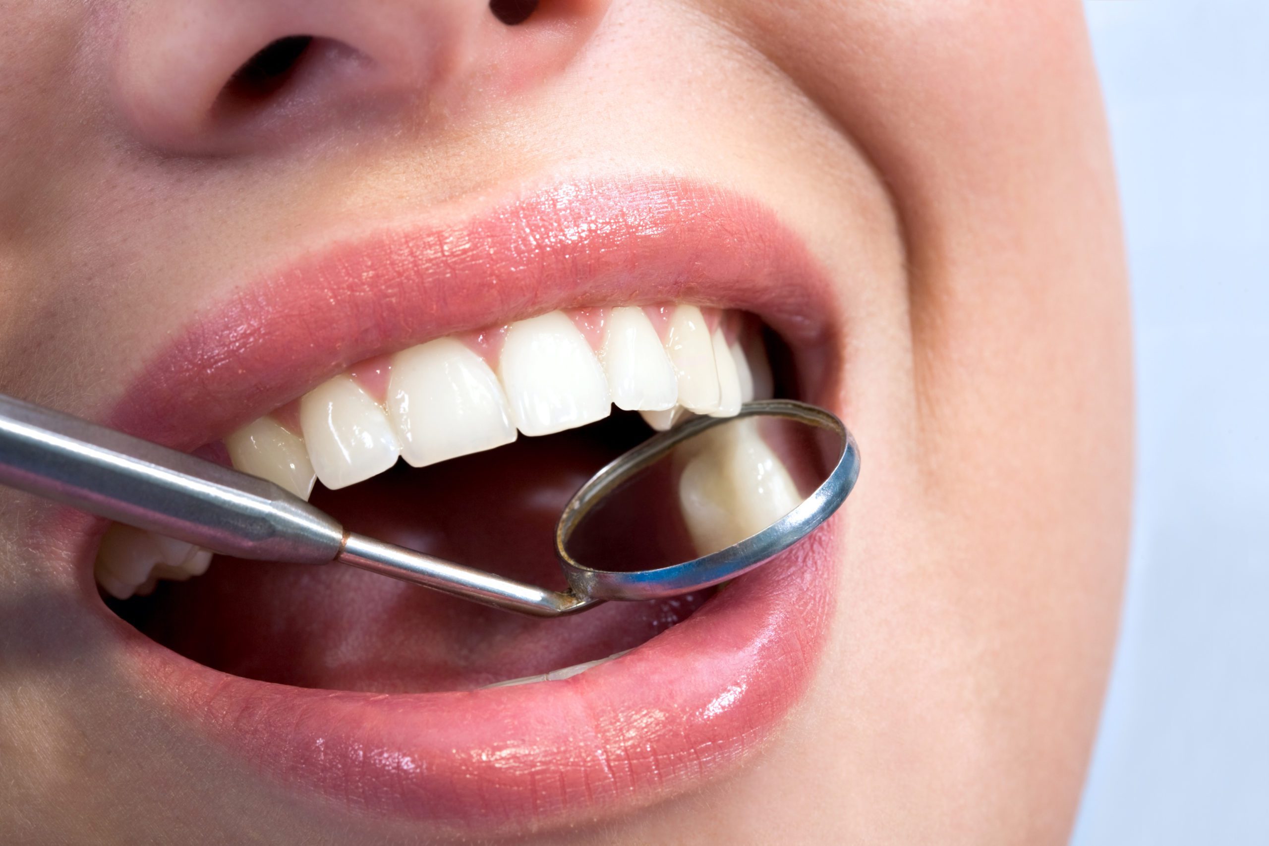 7 Factors That Can Affect the Cost of Orthodontic Treatment - Lineberger Orthodontics